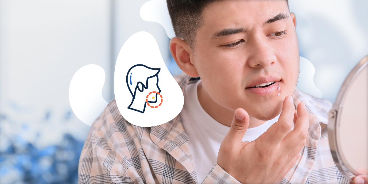 How to Prevent Cold Sore